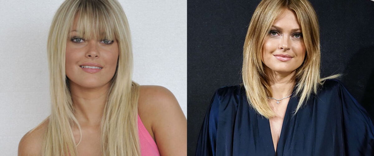 Caroline Receveur Avant Chirurgie