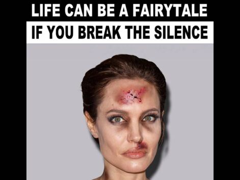 Emma Watson, Angelina Jolie, Kristen Stewart posent le visage défiguré pour lutter contre les violences faites aux femmes