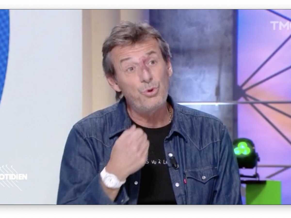 Jean-Luc Reichmann fait de tendres confidences sur sa sœur, sourde profonde, dans Quotidien