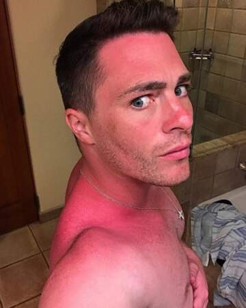 L'acteur Colton Haynes vous rappelle que la crème solaire est indispensable. 