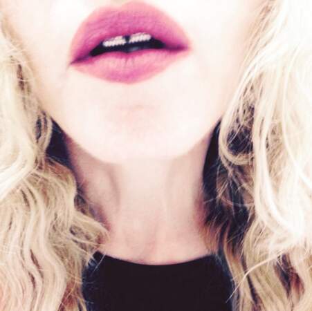 ... Et Madonna a osé le combo rouge à lèvres et grillz de rappeur ! 