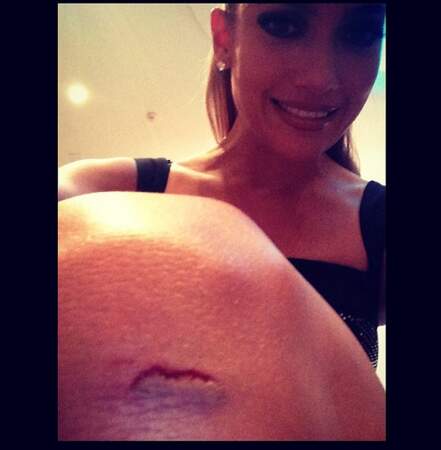 Et Jennifer Lopez s'est blessée au genou. #Aie