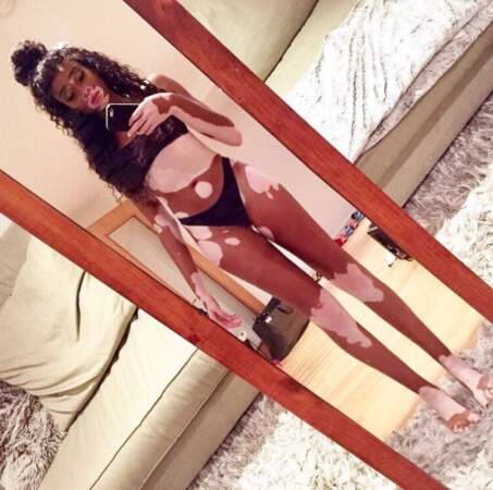 Selfie en lingerie pour la top-model Winnie Harlow. 