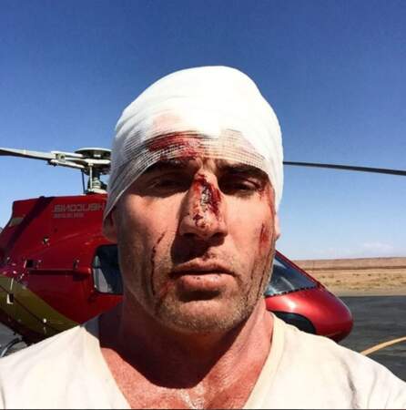 Il y a peu, l'acteur a eu un gros accident qui aurait pu être fatal sur le tournage de Prison Break.