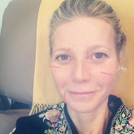 Gwyneth Paltrow a fait hurler de terreur tous les phobiques des aiguilles en un selfie. 
