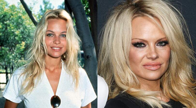 Tout comme Pamela Anderson... 