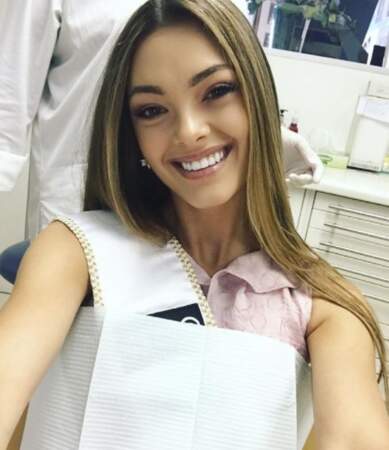 Quelques jours avant Miss Univers, Demi-Leigh Nel-Peters a effectué un blanchiment dentaire