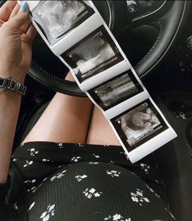 Stéphanie Clerbois, elle aussi enceinte, a publié une photo de son échographie